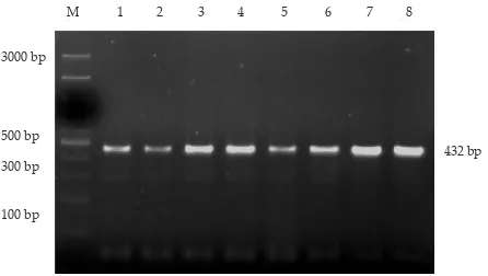 Figure 1. Visualization of the amplified GH gene fragment on ��� ���������� ����� ���� ������ ����������