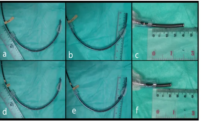 Gambar 1 Metode Pengukuran Ujung ETT ke Jarak Carina                               Ket.: Fiberoptic bronchoscope dimasukkan ke dalam ETT hingga ujung distal