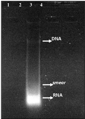 Figure 1. Result of DNA electrophoresis  by                Doyle and Doyle’s method (1990)  