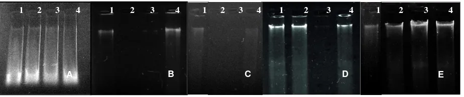 Figure 2. Electrophoresis result with modifications   A) Modified-1; B) Modified-2; C) Modified-3; D) Modified-4; E) Modified-5 