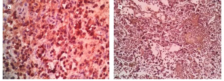 Gambar 5.1 (a) dan (b). Gambaran imunohistokimia ekspresi MMP-9  