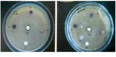 Gambar 3 Aktivitas antibakterial ekstrak metanolterhadap E. coli (A) dan S. aureus (B)