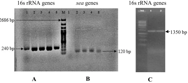Figure 1. PCR products of partial sequence of 16S rRNA amplified by primer (A) 16sF/16sR3, (B) SEA1/SEA2, and (C) 63F/1387R