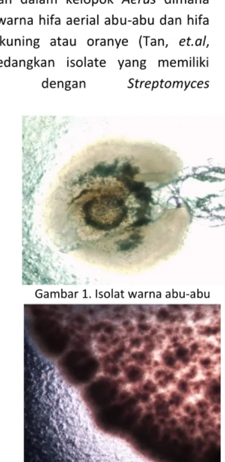 Gambar 3. Isolatwarna ungu  Gambar 4 Isolat warna kuning  Aktifitas antibakteri dari kultur cair 