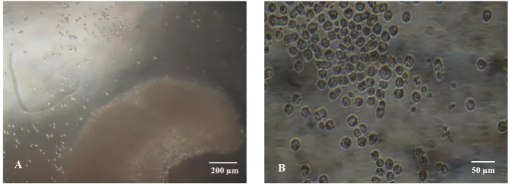 Figure 1.  A) A pair of gonads (a) attached to the mesonephros chicken embryo. B) A pair of gonads that were removed from the me356 358 -sonephros and ready to be isolated.