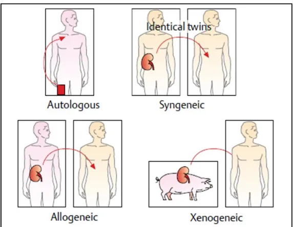 Gambar 1. Tipe Transplantasi (Burmester & Pezzuto, 2003).