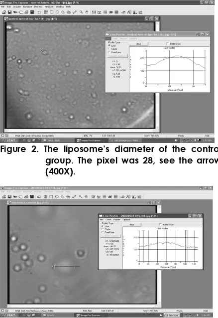 Figure 3. The diameter of large liposome in the day  of 7.  The pixel was 75 (400X). 