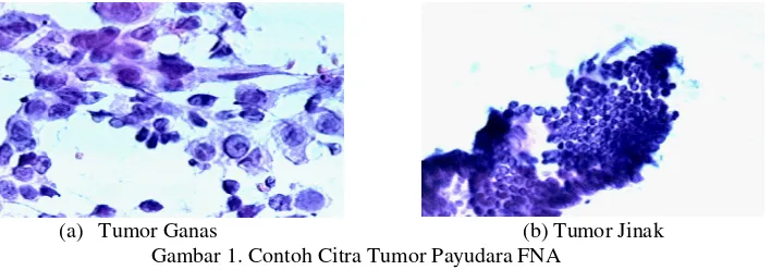 Gambar 1. Contoh Citra Tumor Payudara FNA 