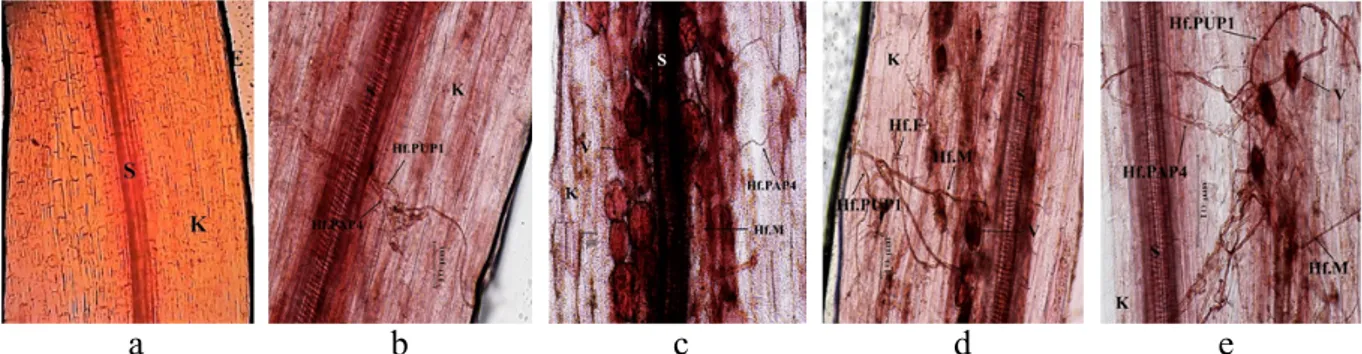 Gambar 3 Jaringan akar tanaman bawang merah pada perlakuan kombinasi mikoriza arbuskular  dan  cendawan  endofit:  (a)  akar  yang  tidak  terkolonisasi  agens  biokontrol,  (b)  kolonisasi  cendawan endofit PAP4 dan PUP1, (c) kolonisasi PAP4 dan MA, (d) k