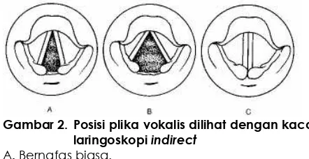 Gambar 2.  Posisi plika vokalis dilihat dengan kaca laringoskopi indirect 