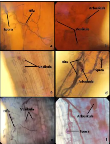 Gambar 7. Struktur koloni FMA pada akar tanaman revegetasi (400x) pewarnaan dengan 