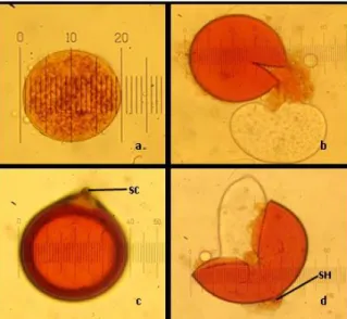 Gambar 4. Bentuk Spora Glomus (400x) hasil pewarnaan dengan melzer’s reagent ; (a).  Permukaan spora kasar, (b)