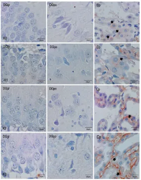 Gambar 4  Gambaran Histopatologis  