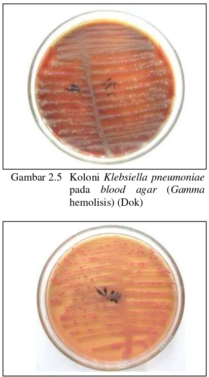 Gambar 2.5  Koloni Klebsiella pneumoniae 