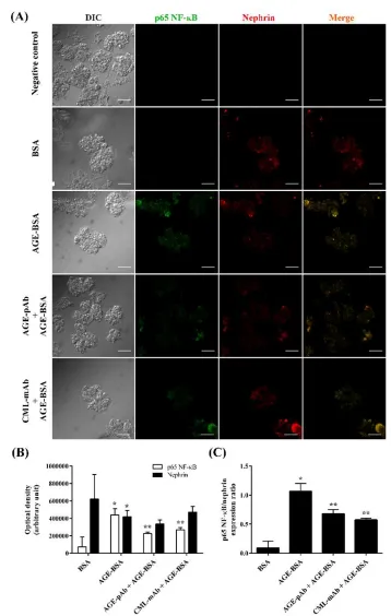 Figure 1.AGEs antibody downregulated glomerular NF-ĸB p65 expression induced by AGEs. A