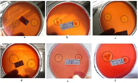 Figure 1. Clearance zone of soil samples on different agar plates was created after 48 hours of incubation