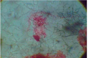 Figure 2. Micrograph of E. coli after gram staining