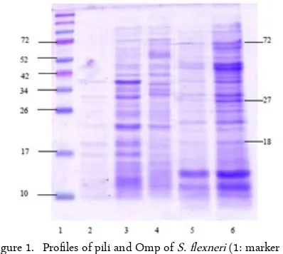 Figure 1. Profiles of pili and Omp of S. flexneri (1: marker pro-tein; 2 and 3: pili slices 1 and 2 of S