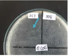 Gambar 2. Uji Isolat 2CT terhadap Escherichia coli ditunjukkan dengan adanya zona bening di sekitar goresan isolate 