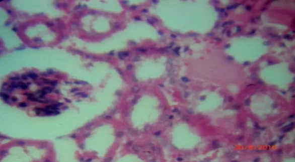 Gambar 13.  Kelompok P2,M4 (1) :  (a) Degenerasi hidrophilik, dengan     perubahan sel dan  inti yang  membengkak [Tanda panah] (HE – 400 X) 