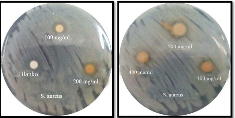 Gambar 4.1 Zona hambat bakteri Staphylococcus aureus Ekstrak Metanol 