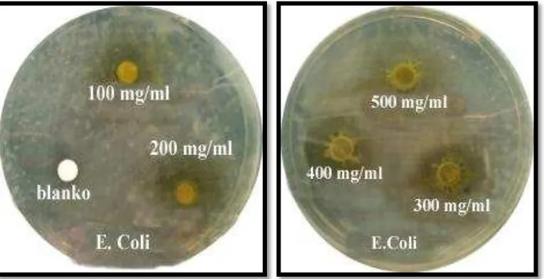 Gambar 4.3  Zona hambat bakteri Staphylococcus aureus Ekstrak Etil Asetat 