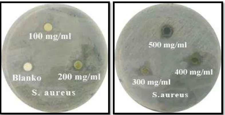 Gambar 4.6  Zona hambat bakteri Escherichia coli Ekstrak n-Heksana 