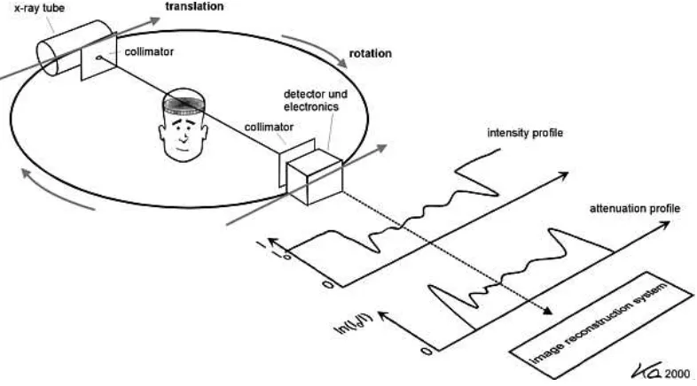 FIG. 5.  Simplified diagram of creation of an attenuation profile in a CT scan. Note that modern scanners use a fan beam to acquire the attenuation profile in one exposure (courtesy: W.A