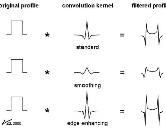 FIG. 8.  Image characteristics can be influenced by the choice of convolution kernel, whereby increasing spatial resolution or edge enhancement also means increasing image noise (courtesy: W.A