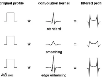 FIG. 8.  Image characteristics can be influenced by the choice of convolution kernel, whereby increasing spatial resolution or edge enhancement also means increasing image noise (courtesy: W.A