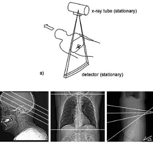 FIG. 9.  Scout scan radiographs are taken with low dose and low spatial resolution by transporting the patient through the field of measurement with the X ray tube in a fixed position (a)