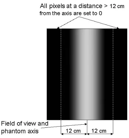 FIG. 18.  Schematic example of a sinogram sum profile and definition of the ROI.