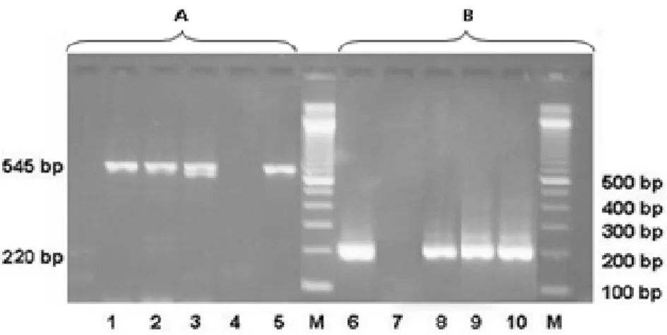 Gambar 1. Hasil elektroforesis produk RT-PCR. A. Hasil elektroforesis gen H5 pada 545 bp