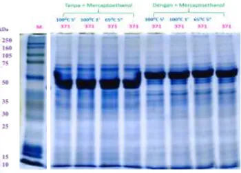 Gambar 1. Isolat S371 hasil elektroforesis SDS-PAGE
