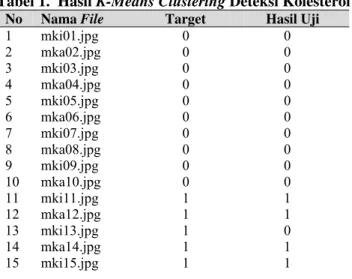 Tabel 1.  Hasil K-Means Clustering Deteksi Kolesterol 