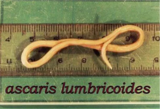 Gambar 1. Cacing Ascaris lumricoides 