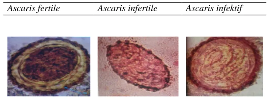 Gambar 3. Morfologi telur cacing Ascaris lumbricoides   2)  Ancylostoma duodenale dan Necator americanus (Cacing Tambang) 