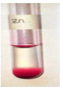 Gambar 6. Uji kualitatif natrium dengan pereaksi asam pikrat 1% 