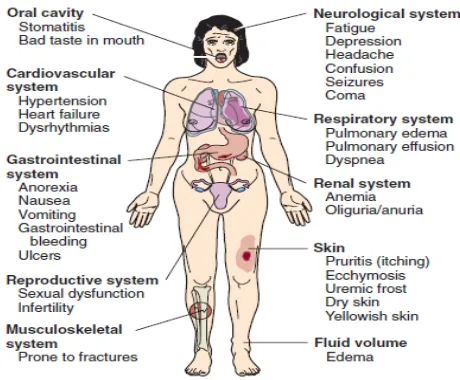 Gambar 3. Gejala CKD (Schrier, 20030 