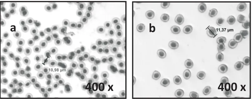 Gambar 4. Sampel sel darah merah diploid (a) dan triploid (b)ikan lele sangkuriang dengan pembesaran 400 kali.