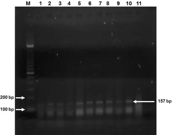 Gambar  1.  Visualisasi  ekpresi  mRNA  BRLF1  EBV  dengan  RT-PCR  (M,  Marka  DNA  100  bp;  Ekpresi  mRNA BRLF1 EBV positif pada sumuran no