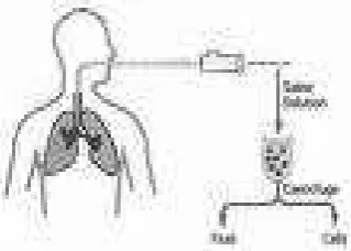 Gambar bronko alveolar lavage 