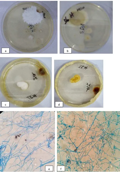 Gambar a,b,c,d. Foto makroskopis T. mentagrophytes Gambar e,f. Foto mikroskopis T. mentagrophytes  