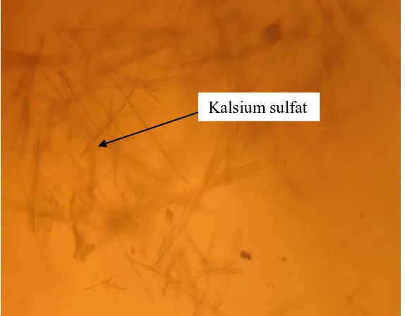 Gambar 7. Hasil Analisis Kualitatif Kalsium dengan Ammonium Oksalat pada Cacing Tanah Drawida sp