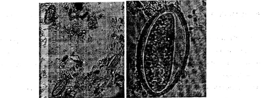 Gambar l. Telur Sjaponicumperbesaran l0x (kiri) dan perbesaran 40x (kanan) yang ditemukan