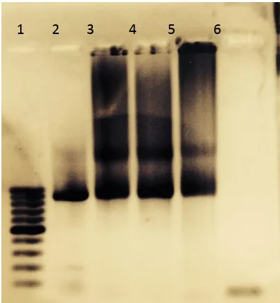 Gambar 1. Elektroforegram Hasil Optimasi    Suhu Annealing PCR Fragmen DNA Pengkode Integrase HIV-1