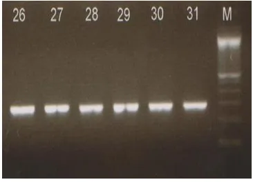 Gambar 2. Hasil elektroforesis amplify-kasi gen ctx dengan Gel Agarosa 2% (M: marker, 31: Kontrol Positif, 26-30: Sampel Air) 
