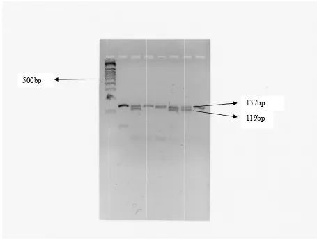 Gambar 4.2 Digestianalisa terlihati produk Pelektroforet alel AA daPCR gen Mesis agarosan AG 137bMMP-12 dsa 4% sampbp dan 119dengan enzpel P19, P29bp, tidak tim Restrik20, P21, P2tampak aleksi  Pvu II26, N9, N10l GG 18bp I 0  