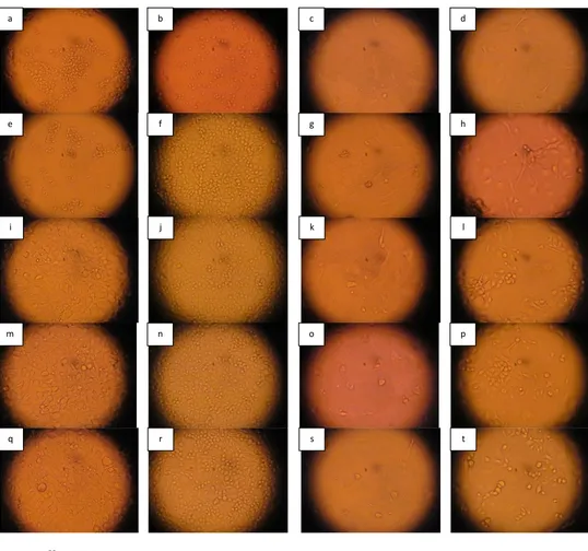 Gambar 2. Morfologisel RD, Sel L20B dan SPM Mencit pada Hari Ketujuh Setelah Uji Sensitivitas Terhadap Poliovirus Tipe I (Perbesaran 100x) 