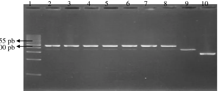 Gambar 1.  Verifikasi hasil kloning plasmid rekombinan dengan pemotongan enzim Xba I. Lajur 1: 